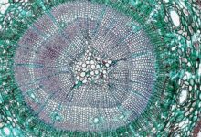 medical term exploration guide